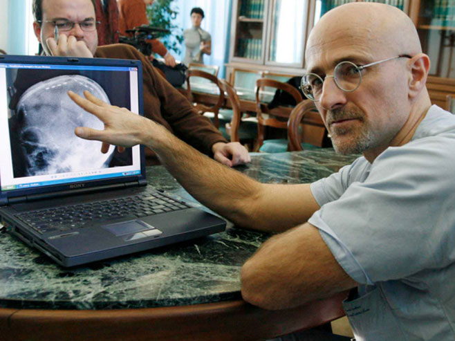 Др Серђо Канаверо планира трансплантацију људске главе (Фото: East News) - 