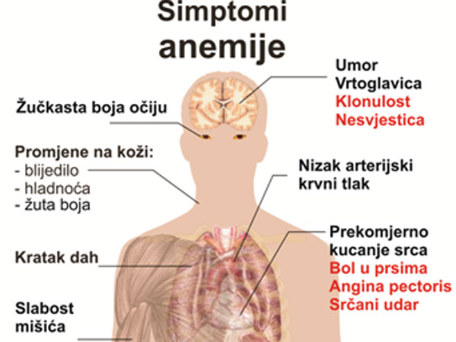 Симптоми анемије - 