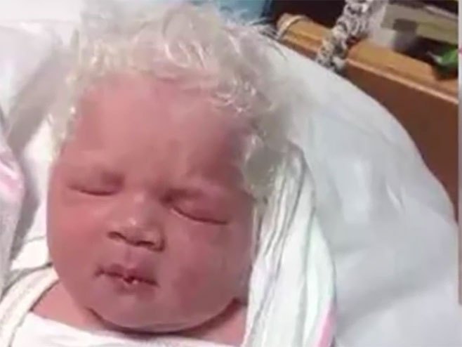 Мали Мађар рођен са бијелом косом - Фото: Screenshot/YouTube