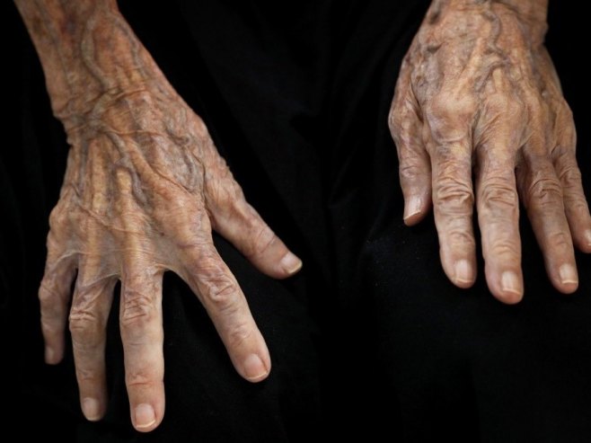 Стогодишњакиња, илустрација (фото: EPA/RUNGROJ YONGRIT) Стогодишњакиња, илустрација (фото: EPA/RUNGROJ YONGRIT) -