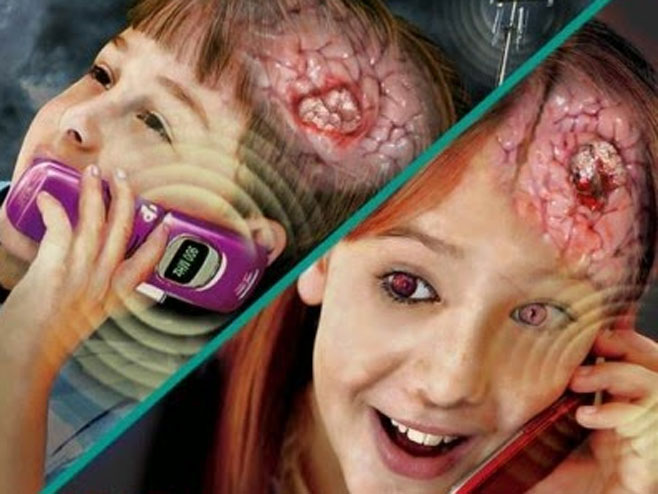 Претјерана употреба мобилних телефона узрокује тумор на мозгу? (илустрација) - 